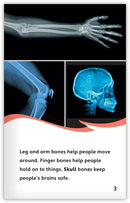 Broken Bones (Fables & The Real World)