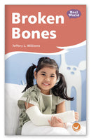 Broken Bones (Fables & The Real World)